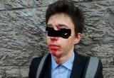 В Архангельске подросток порезал лицо о железный забор (ФОТО)