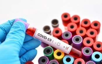 Больше 30 случаев: статистика по коронавирусу взлетела на этой неделе в Коряжме