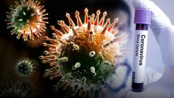 38 случаев коронавируса выявили в Коряжме за последнюю неделю